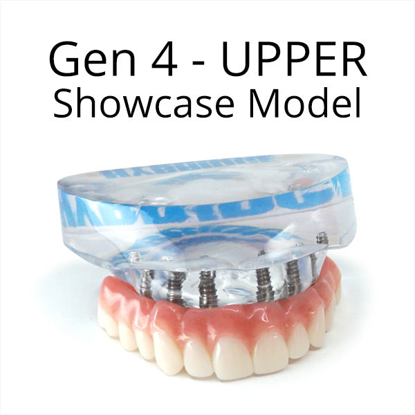Gen 4 Showcase Model (UPPER)