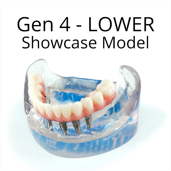 Gen 4 Showcase Model (LOWER)